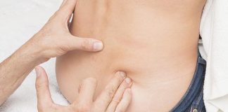 Displasia de cadera Displasia de cadera